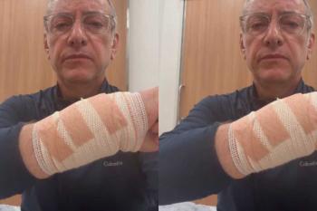 “O preço da irresponsabilidade”: jornalista da Globo relata ataque de pitbull durante passeio