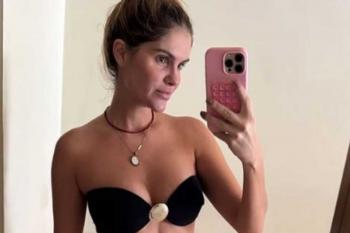 “Minha barriga é toda costurada”, diz Bárbara Evans ao mostrar cicatriz