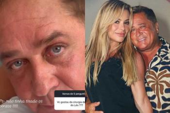 Esposa avalia cirurgia de Leonardo e diz que cantor “rejuvenesceu dez anos”