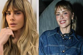 Carolina Dieckmmann mostra resultado de procedimento no rosto
