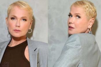 Xuxa mostra resultado de transplante capilar e fala sobre luta contra alopecia