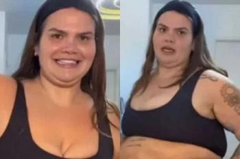 Thais Carla rebate críticas e explica tratamento antes de cirurgia: “Pele flácida”