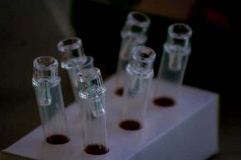 Desinformação sobre HIV dificulta tratamento e aumenta preconceito