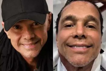 “Meu cabelo voltou a crescer”, comemora Netinho após tratamento contra câncer