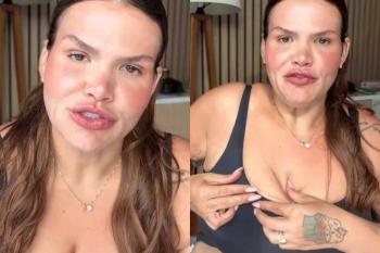 “Não é fácil lidar”, diz Thais Carla ao mostrar flacidez após perder 100 kg