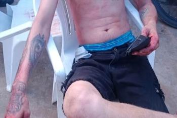 Jovem é atacado a facadas em bar na  T-28 em Ji-Paraná