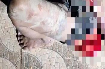 Mulher é atacada com várias facadas na região central de Porto Velho