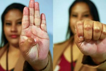 Governo de Rondônia vai capacitar estabelecimentos públicos e privados para maior segurança e acolhimento das mulheres     