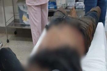 Foragido da Justiça é baleado e preso após trocar tiros com a Polícia Militar