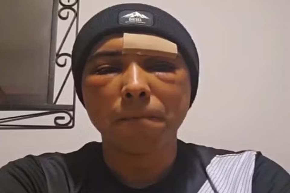 “Não tive tempo de me defender”, diz brasileiro agredido na Irlanda