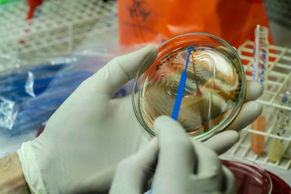 Casos suspeitos de Monkeypox em Rondônia são descartados; resultado é emitido por laboratório referência