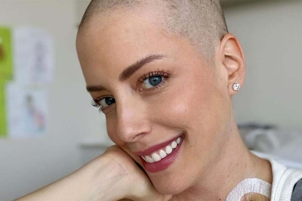 Fabiana Justus relata mudança na pele após transplante de medula: 'Bem sensível'