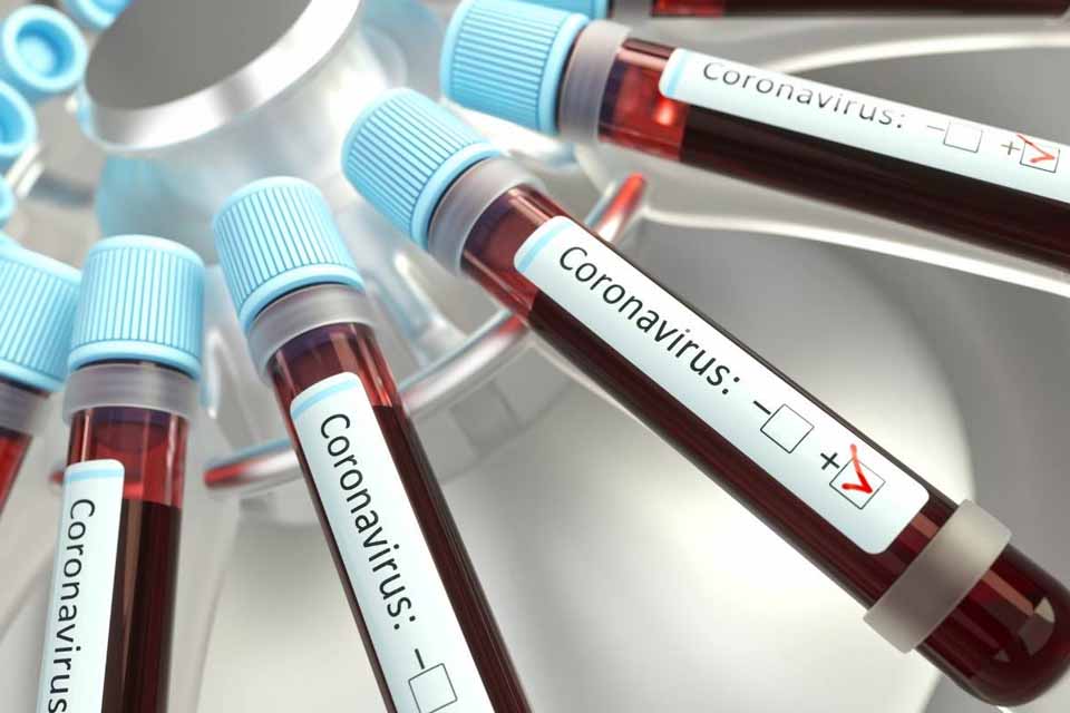 Novo Coronavírus: Rondônia tem 92 casos confirmados; 58 apenas na capital