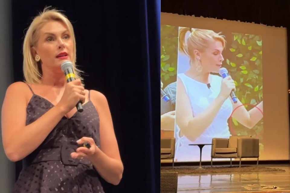 Ana Hickmann mostra hematomas e se emociona: “Senti vergonha dos machucados”