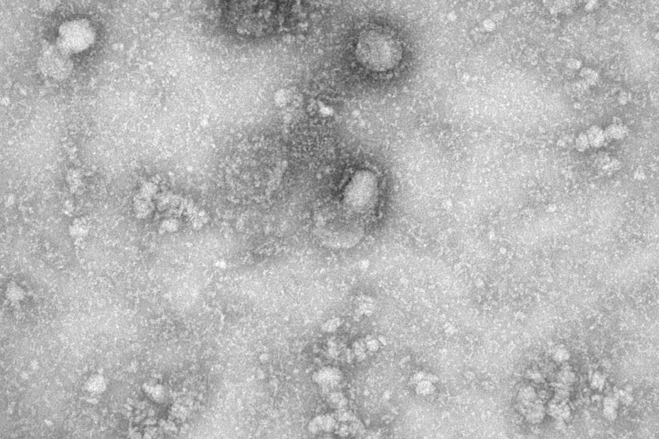 Publicada MP que destina recursos para enfrentamento do coronavírus