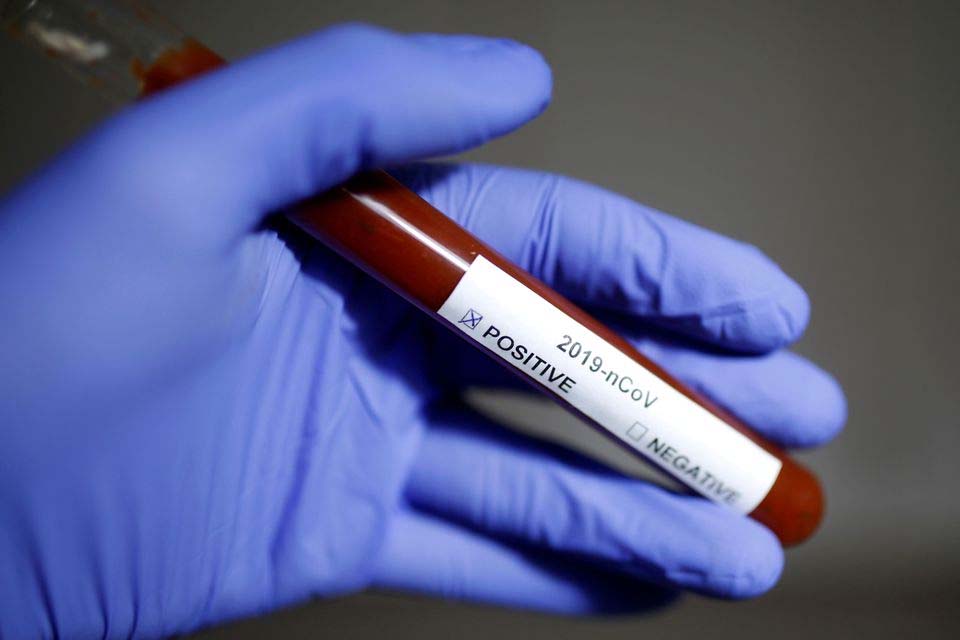 Nota Pública - SEMUSA confirma 10° caso do novo Coronavírus em Porto Velho