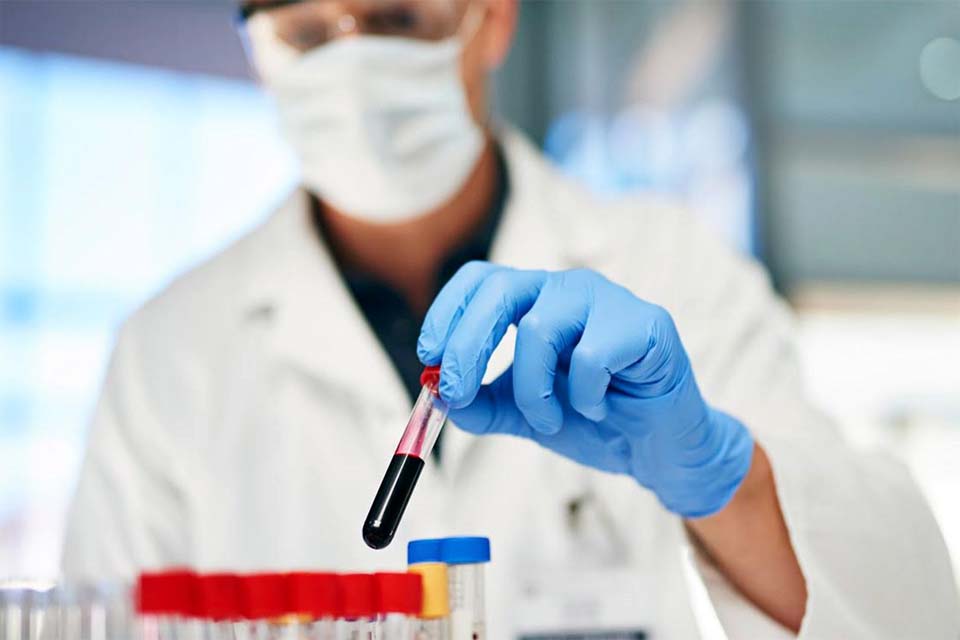 Confira quais são os laboratórios credenciados para realização de exames pelo SUS em Jaru