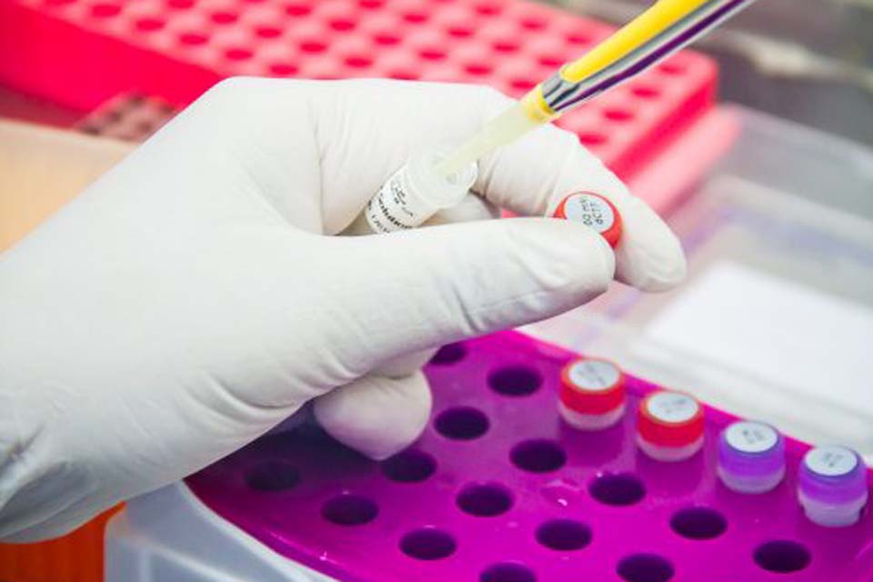 Com um óbito para cada 48 pessoas positivas à Covid-19, governo de Rondônia pede cautela à população no feriado