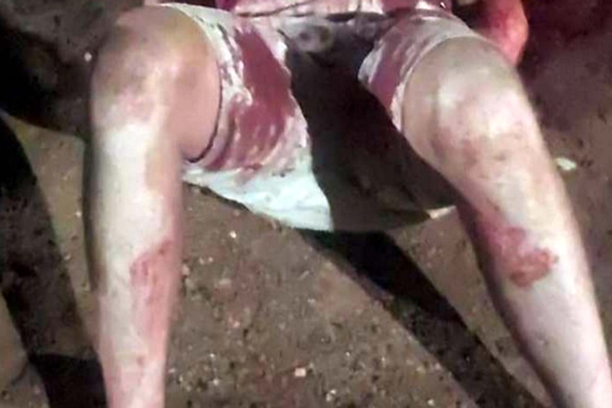 Homem fica com as vísceras expostas após ser esfaqueado no pátio de posto