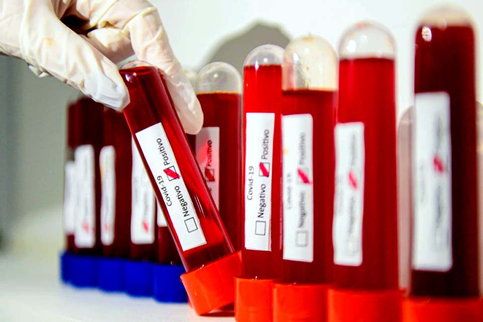 Nove em 10 pacientes curados da covid-19 apresentam efeitos colaterais