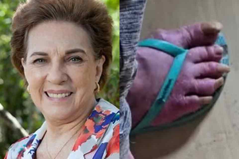 Ex-atriz da Globo é encontrada em situação de abandono em Porto Alegre: “Estava com muita fome”