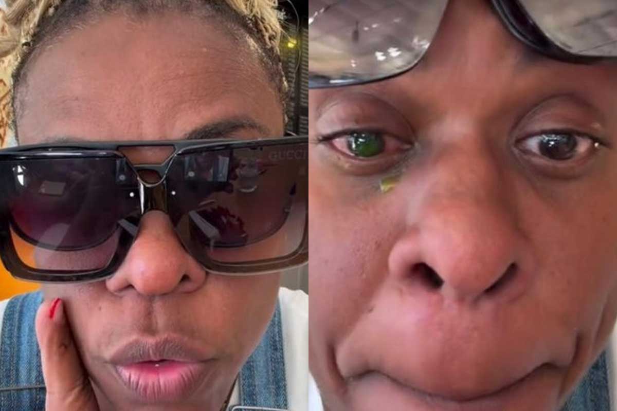 “Dor insuportável”: Cacau Protásio relata reação após uso de pomada capilar